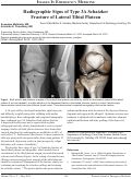 Cover page: Radiographic Signs Of Type 3A Schatzker Fracture Of Lateral Tibial Plateau