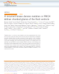 Cover page: A recurrent kinase domain mutation in PRKCA defines chordoid glioma of the third ventricle.