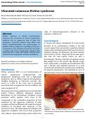 Cover page: Ulcerated cutaneous Richter syndrome