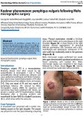 Cover page: Koebner phenomenon: pemphigus vulgaris following Mohs micrographic surgery