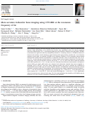 Cover page: More accurate trabecular bone imaging using UTE MRI at the resonance frequency of fat