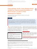 Cover page: Transcatheter Aortic Valve Replacement Guided by Preprocedural Simulation of Fluoroscopic Location of the Membranous Septum.