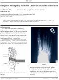 Cover page: Images in Emergency Medicine : Lisfranc Fracture-Dislocation