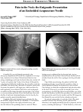 Cover page: Pain in the Neck - The Enigmatic Presentation of an Embedded Acupuncture Needle