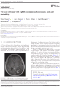 Cover page: 72‐year‐old man with right homonymous hemianopia and gait instability