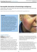 Cover page: Eosinophilic dermatosis of hematologic malignancy