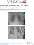 Cover page: Subcutaneous Emphysema After Chest Trauma