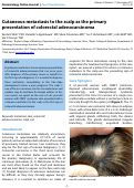 Cover page: Cutaneous metastasis to the scalp as the primary presentation of colorectal adenocarcinoma