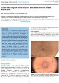 Cover page: Circle hair: report of two cases and brief review of the literature