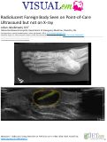 Cover page: Radiolucent Foreign Body Seen on Point-of-Care Ultrasound but not on X-ray