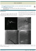 Cover page: EUS-guided bilateral biliary access and metal stent placement post-Whipple resection