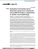 Cover page: Evaluation of prostate cancer detection using micro-ultrasound versus MRI through co-registration to whole-mount pathology.