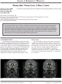 Cover page: Monocular Vision Loss: A Rare Cause