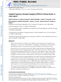 Cover page: Spatial Frequency Domain Imaging (SFDI) of clinical burns: A case report