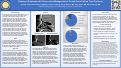 Cover page: Treatment Outcomes with Conservative Management of Frontal Sinus Outflow Tract Fractures