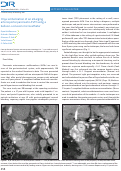 Cover page: Onyx embolization of an enlarging arterioportal pancreatic AVM using a balloon-occlusion microcatheter