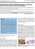 Cover page: Subepidermal calcified nodule presenting as a cutaneous horn: two cases and a review of the literature