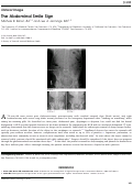 Cover page: The Abdominal Smile Sign