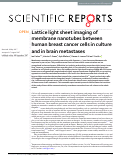 Cover page: Lattice light sheet imaging of membrane nanotubes between human breast cancer cells in culture and in brain metastases.