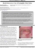 Cover page: Bezold Abscess in a Case of Eosinophilic Otitis Media