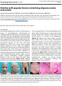 Cover page: Atrichia with papular lesions mimicking alopecia areata universalis