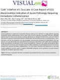 Cover page: Cath’ It Before It’s Too Late: A Case Report of EKG Abnormalities Indicative of Acute Pathology Requiring Immediate Catheterization