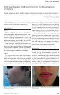 Cover page: Small pustules (pin-sized) distributed on the lateral aspects of the face