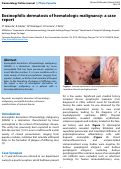 Cover page: Eosinophilic dermatosis of hematologic malignancy: a case report