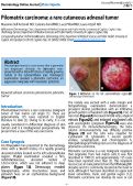 Cover page: Pilomatrix carcinoma: a rare cutaneous adnexal tumor.
