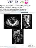 Cover page: Sigmoid Diverticulitis Complicated by Colovesicular Fistula Presenting with Pneumaturia
