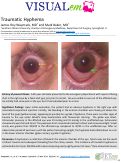 Cover page: Traumatic Hyphema