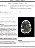 Cover page: Middle Cerebral Artery Arrow Sign