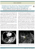 Cover page: Cholangiocarcinoma obscured by a large paraesophageal hernia causing traction compression of the common hepatic duct ultimately diagnosed with percutaneous cholangioscopy.