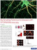 Cover page: Illuminating Parkinson’s Disease with STORM Microscopy