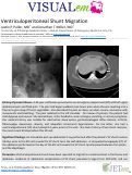 Cover page: Ventriculoperitoneal Shunt Migration