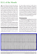 Cover page: ECG of the Month. Arrhythmia.