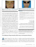 Cover page: The Challenge of Regrowing Hair With Lasers in Androgenetic Alopecia