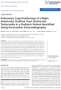 Cover page: Pulmonary Cusp Positioning of a Right Ventricular Outflow Tract Ventricular Tachycardia in a Pediatric Patient Identified Using Intracardiac Echocardiography.