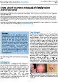 Cover page: A rare case of cutaneous metastasis of distal phalanx chondrosarcoma.