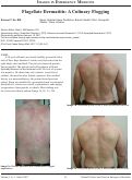 Cover page: Flagellate Dermatitis: A Culinary Flogging