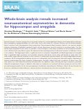 Cover page: Whole-brain analysis reveals increased neuroanatomical asymmetries in dementia for hippocampus and amygdala
