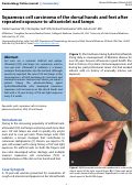 Cover page: Squamous cell carcinoma of the dorsal hands and feet after repeated exposure to ultraviolet nail lamps