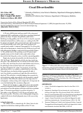 Cover page: Cecal diverticulitis.