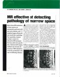 Cover page: MR effective at detecting pathology of marrow space.