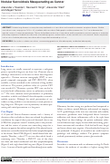 Cover page: Nodular Sarcoidosis Masquerading as Cancer