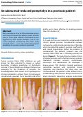 Cover page: Secukinumab-induced pompholyx in a psoriasis patient