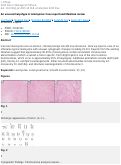 Cover page: An unusual karyotype in leiomyoma: Case report and literature review.