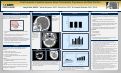 Cover page: Post-traumatic Cerebral Venous Sinus Thrombosis: Prevalence and Risk Factors