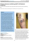 Cover page: Primary cutaneous smoldering adult T-cell leukemia/ lymphoma
