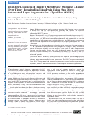 Cover page: Does the Location of Bruch's Membrane Opening Change Over Time? Longitudinal Analysis Using San Diego Automated Layer Segmentation Algorithm (SALSA)Stability of Bruch's Membrane Opening Location Over Time